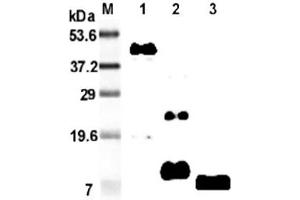 Western blot analysis using anti-RELM-β (mouse), mAb (MRB 46L)  at 1:2'000 dilution. (RETNLB anticorps)