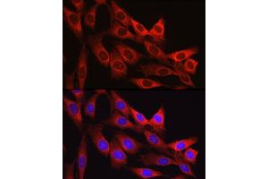 Immunofluorescence analysis of NIH/3T3 cells using Vinculin antibody (ABIN6128911, ABIN6150070, ABIN6150071 and ABIN6218474) at dilution of 1:150.