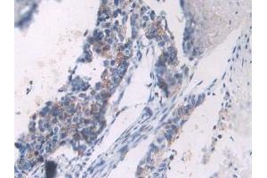 Detection of PCOLCE in Human Lung Tissue using Polyclonal Antibody to Procollagen C-Endopeptidase Enhancer (PCOLCE)