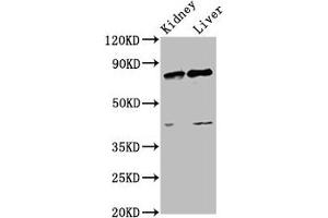 Western Blot Positive WB detected in: Rat kidney tissue, Rat liver tissue All lanes: SUZ12 antibody at 3. (SUZ12 anticorps  (AA 131-305))