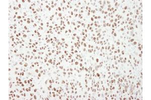 Immunohistochemistry (IHC) image for anti-Minichromosome Maintenance Complex Component 6 (MCM6) (C-Term) antibody (ABIN7448657) (MCM6 anticorps  (C-Term))