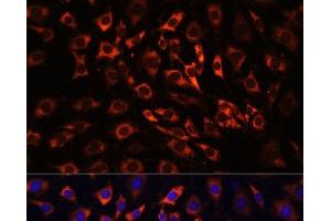 Immunofluorescence analysis of C6 cells using ERK1 / ERK2 Polyclonal Antibody at dilution of 1:100 (40x lens). (ERK1/2 anticorps)