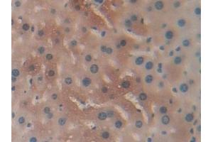 Detection of CBG in Mouse Liver Tissue using Polyclonal Antibody to Corticosteroid Binding Globulin (CBG)