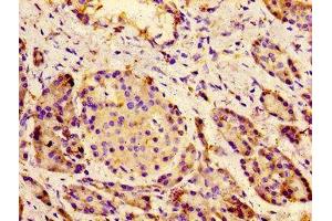 Immunohistochemistry of paraffin-embedded human pancreatic tissue using ABIN7175586 at dilution of 1:100 (CACNA1C anticorps  (AA 1755-1971))
