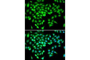 Immunofluorescence analysis of U2OS cells using DDX21 antibody.