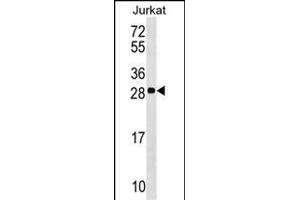 ANP32C Antibody (Center) (ABIN1537820 and ABIN2848975) western blot analysis in Jurkat cell line lysates (35 μg/lane). (ANP32C anticorps  (AA 130-158))
