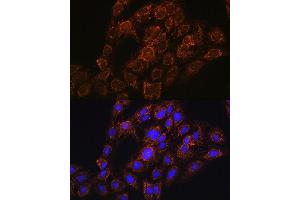 Immunofluorescence analysis of C6 cells using CHCHD2 antibody (ABIN7266448) at dilution of 1:100. (CHCHD2 anticorps  (AA 75-145))