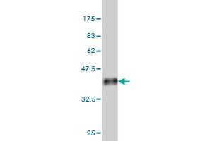 Western Blot detection against Immunogen (36. (Calpain 9 anticorps  (AA 591-690))
