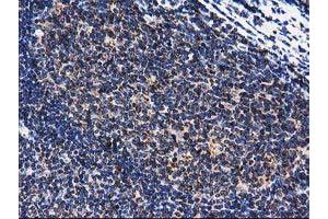 Image no. 10 for anti-ClpP Caseinolytic Peptidase, ATP-Dependent, Proteolytic Subunit Homolog (E. Coli) (CLPP) antibody (ABIN1497535)