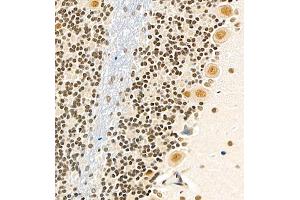 Immunohistochemistry of paraffin embedded rat cerebellum using USP27 (ABIN7076113) at dilution of 1:700 (400x lens) (USP27X anticorps)