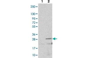 Western blot analysis of Lane 1: Negative control (vector only transfected HEK293T lysate). (ANKRD39 anticorps)