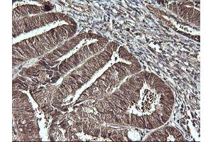 Image no. 7 for anti-Cell Division Cycle 123 Homolog (CDC123) antibody (ABIN1497388)
