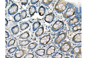Phospho-Lamin A/C (Ser22) Antibody at 1/100 staining Rat stomach tissue by IHC-P.
