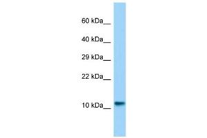 Host:  Rabbit  Target Name:  Lsm10  Sample Type:  Rat Testis lysates  Antibody Dilution:  1. (LSM10 anticorps  (N-Term))