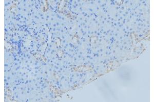 ABIN6279466 at 1/100 staining Mouse kidney tissue by IHC-P. (SAR1A anticorps  (Internal Region))
