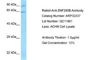 Western Blotting (WB) image for anti-Zinc Finger Protein 280B (ZNF280B) (N-Term) antibody (ABIN2779515)