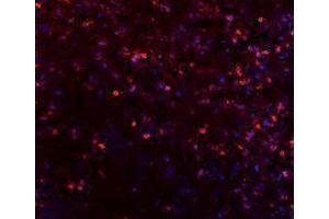 Immunofluorescence (IF) image for anti-Inducible T-Cell Co-Stimulator (ICOS) antibody (Alexa Fluor 647) (ABIN2657721) (ICOS anticorps  (Alexa Fluor 647))