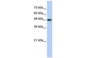 Image no. 1 for anti-Carboxypeptidase N Subunit 1 (CPN1) (AA 323-372) antibody (ABIN6743604) (CPN1 anticorps  (AA 323-372))