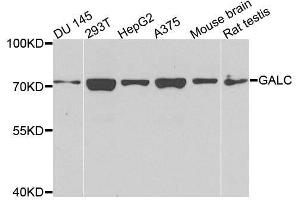 Western blot analysis of extracts of various cell lines, using GALC antibody.