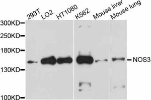 Western blot analysis of extracts of various cell lines, using NOS3 antibody. (ENOS anticorps  (AA 1-120))