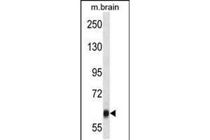 Western blot analysis in mouse brain tissue lysates (35ug/lane).