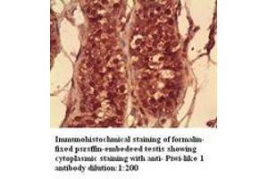 Image no. 1 for anti-Piwi-Like 1 (PIWIL1) antibody (ABIN790907) (PIWIL1 anticorps)