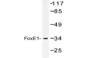 Western blot (WB) analysis of FoxE1 antibody in extracts from HUVEC cells.
