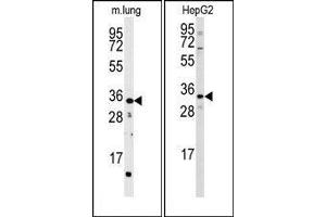 Image no. 1 for anti-CTD (Carboxy-terminal Domain, RNA Polymerase II, Polypeptide A) Small Phosphatase 2 (CTDSP2) (N-Term) antibody (ABIN360802)