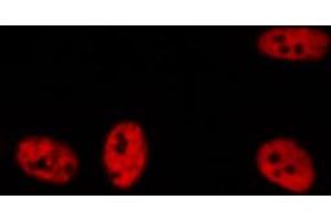 ABIN6272258 staining A549 by IF/ICC.