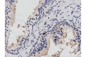 Immunohistochemical staining of paraffin-embedded Human prostate tissue using anti-PTPRE mouse monoclonal antibody. (PTPRE anticorps)