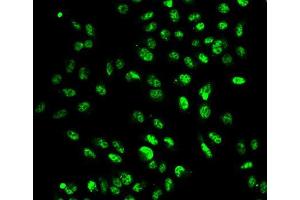 Immunofluorescence analysis of A549 cell using SETD2 antibody. (SETD2 anticorps  (AA 803-1103))