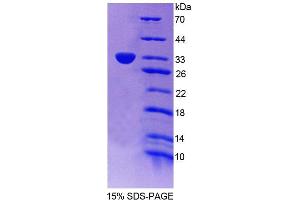 Image no. 1 for Phospholipid Scramblase 5 (PLSCR5) (AA 1-274) protein (T7 tag,His tag) (ABIN6239249) (PLSCR5 Protein (AA 1-274) (T7 tag,His tag))