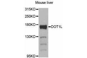 Western blot analysis of extracts of mouse liver, using DOT1L antibody (ABIN5997610) at 1/1000 dilution. (DOT1L anticorps)