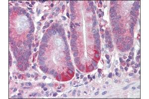 Human Small Intestine (formalin-fixed, paraffin-embedded) stained with RETNLBfollowed by biotinylated anti-goat IgG secondary antibody, alkaline phosphatase-streptavidin and chromogen. (RETNLB anticorps  (Internal Region))