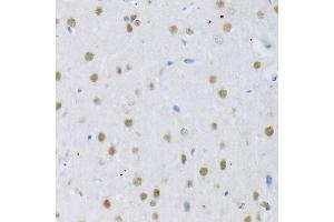 Immunohistochemistry of paraffin-embedded Rat brain using SRSF3 antibody (ABIN6132649, ABIN6148465, ABIN6148466 and ABIN6221693) at dilution of 1:100 (40x lens).