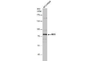 WB Image MX1 antibody detects MX1 protein by western blot analysis. (MX1 anticorps  (Center))