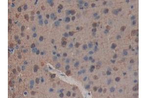 Detection of PLA2R1 in Mouse Brain Tissue using Polyclonal Antibody to Phospholipase A2 Receptor 1 (PLA2R1) (PLA2R1 anticorps  (AA 1418-1487))