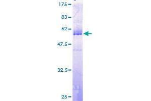 Image no. 1 for TGFB-Induced Factor Homeobox 2 (TGIF2) (AA 1-237) protein (GST tag) (ABIN1322623)