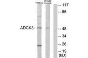 Western blot analysis of extracts from HepG2/mouse muscle cells, using ADCK3 Antibody. (COQ8A anticorps  (AA 301-350))