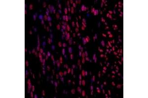 Immunofluorescent analysis of paraformaldehyde-fixed fetal mouse using,Mettl11a (ABIN7074612) at dilution of 1: 1500 (METTL11A anticorps)