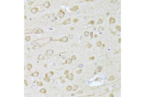 Immunohistochemistry of paraffin-embedded rat brain using FDPS Antibody (ABIN5973369) at dilution of 1/100 (40x lens). (FDPS anticorps)