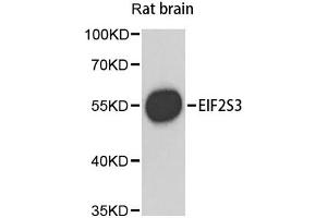Western blot analysis of extracts of rat brain, using EIF2S3 antibody (ABIN1872488) at 1:1000 dilution. (EIF2S3 anticorps)
