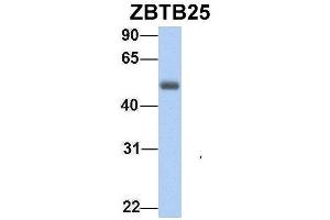 Host:  Rabbit  Target Name:  ZBTB25  Sample Type:  Human Adult Placenta  Antibody Dilution:  1.