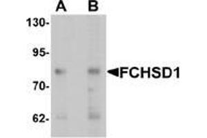 Western blot analysis of FCHSD1 in MCF7 cell lysate with FCHSD1 Antibody  at (A) 0. (FCHSD1 anticorps  (C-Term))