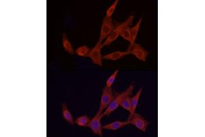 Immunofluorescence analysis of NIH/3T3 cells using  Rabbit pAb (ABIN1678685, ABIN3015308, ABIN3015309 and ABIN6213977) at dilution of 1:150 (40x lens). (APAF1 anticorps  (AA 1-250))