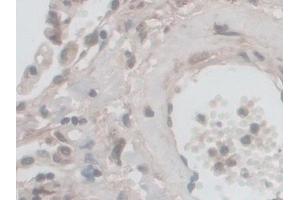 Detection of NOX5 in Human Lung Tissue using Polyclonal Antibody to Nicotinamide Adenine Dinucleotide Phosphate Oxidase 5 (NOX5)