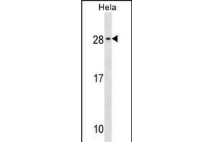 RAB35 Antibody (C-term) (ABIN1536778 and ABIN2849666) western blot analysis in Hela cell line lysates (35 μg/lane). (RAB35 anticorps  (C-Term))