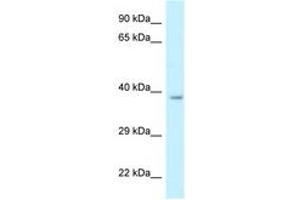 Image no. 1 for anti-Retinol Dehydrogenase 10 (All-Trans) (RDH10) (AA 242-291) antibody (ABIN6747672) (RDH10 anticorps  (AA 242-291))