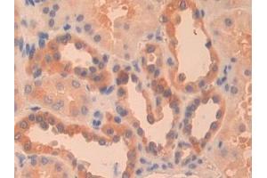 Detection of PKLR in Human Kidney Tissue using Polyclonal Antibody to Pyruvate kinase isozymes R/L (PKLR)