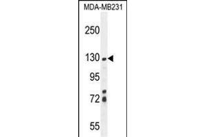 ZSWIM6 Antibody (C-term) (ABIN654590 and ABIN2844290) western blot analysis in MDA-M cell line lysates (35 μg/lane). (ZSWIM6 anticorps  (C-Term))